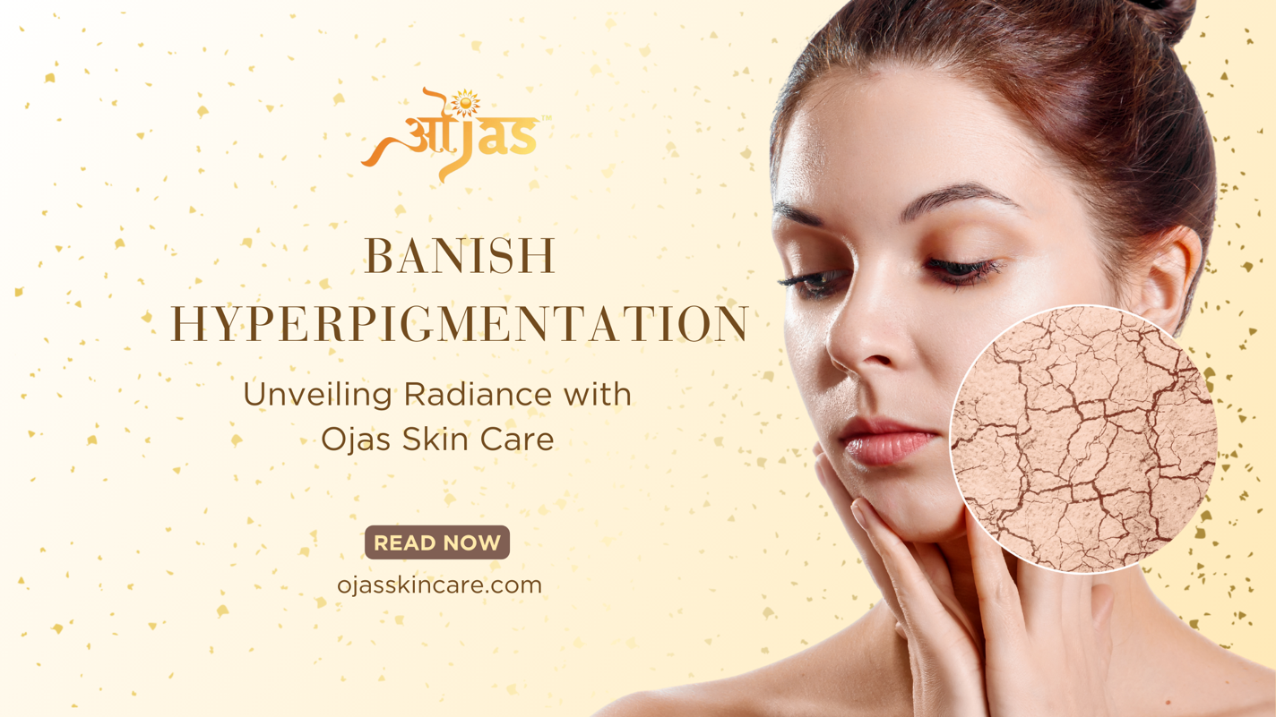 Banish Hyperpigmentation: Unveiling Radiance with Ojas Skin Care
